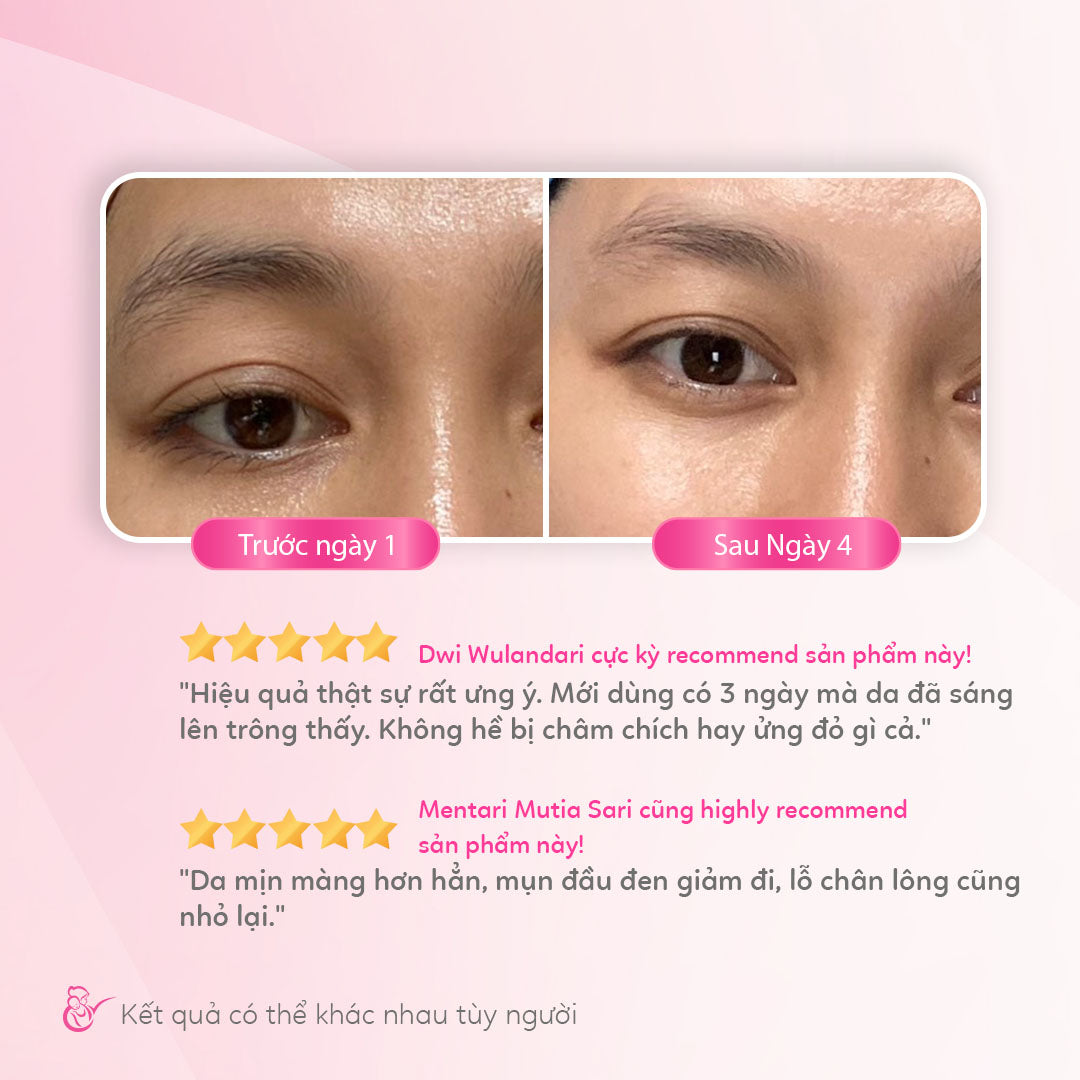 Tinh chất dưỡng sáng da mặt Mama’s Choice Brightening Serum, giảm thâm nám