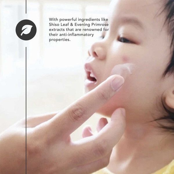 Kem Làm Dịu Da Khô & Giảm Kích Ứng Applecrumby Ultimate Miracle Balm 50ml